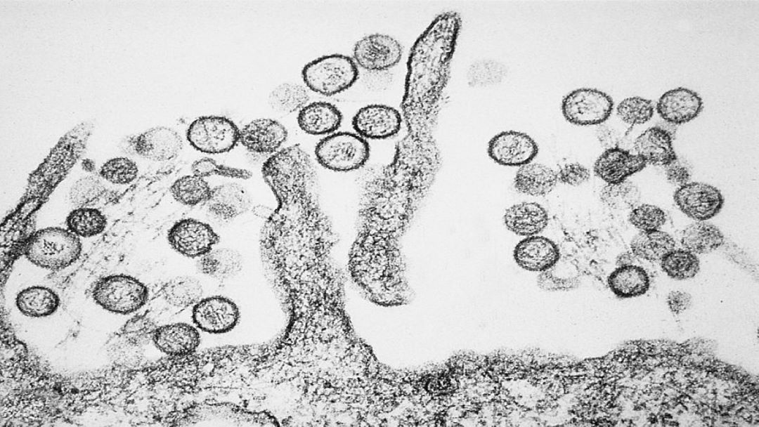 hanta virus